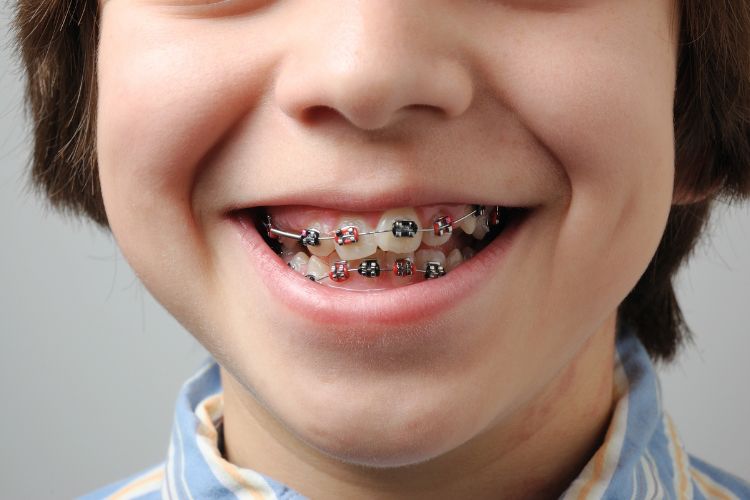 Kids Orthodontics in Peterborough at Serpentine Green Dental