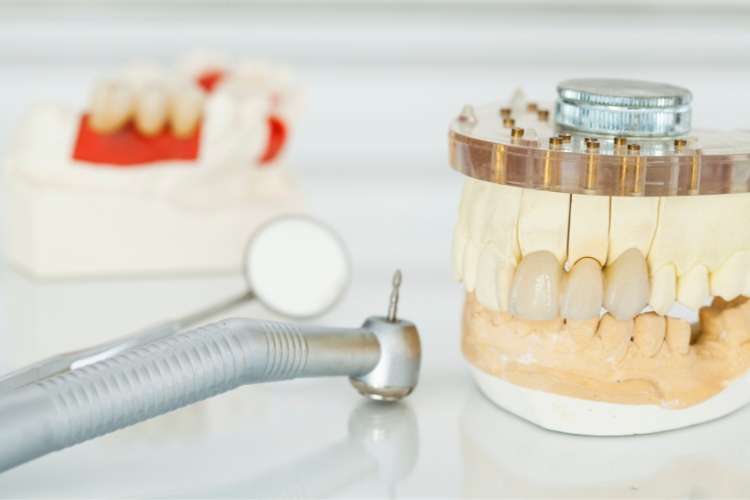 Preparation of dental crowns at Serpentine Green Dental