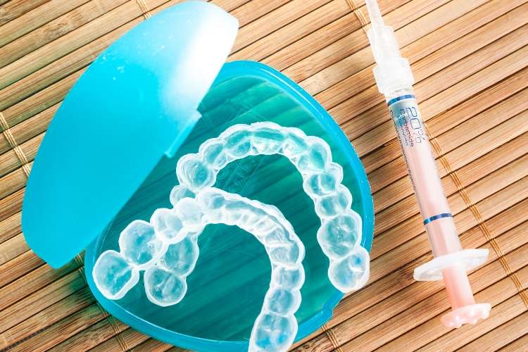 Professional at-home teeth whitening kit