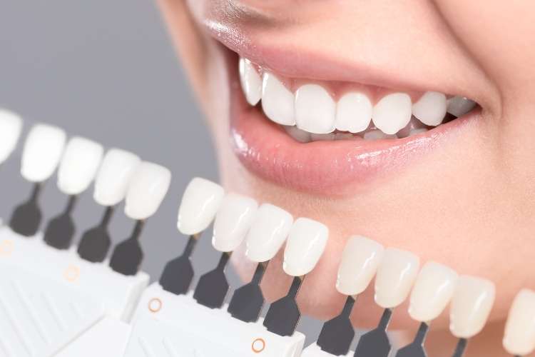 a consultation with your dentist will help you choose your desired look from shape to colour