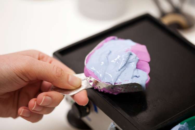 Laboratory made dental splints for a perfect fit