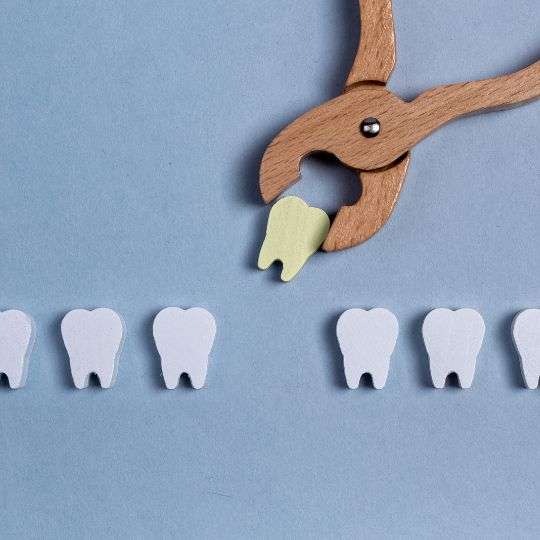 Dental extractions in Peterborough