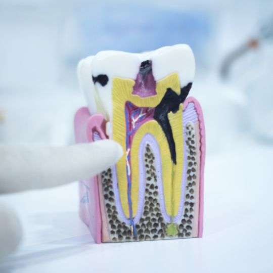 Root canal surgery and root fillings at Serpentine Green Dental