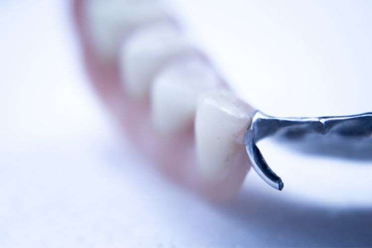 Dentures custom made for your dental requirements