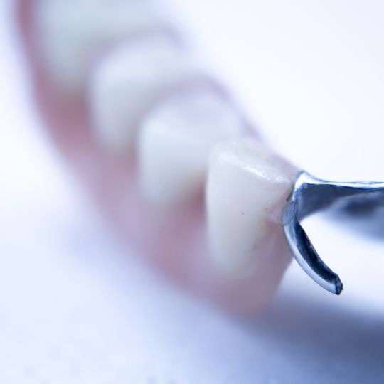 Dentures custom made for your dental requirements